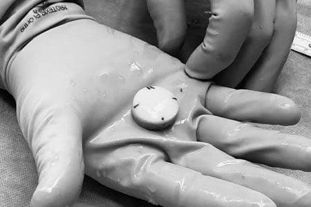 Osteochondral allograft